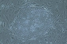  - 
              This undated image made available by the Oregon Health & Science University in May 2013 shows a stem cell colony developed from cloned human embryos. Scientists have finally recovered s