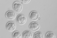  - 
              This undated image made available by the Oregon Health & Science University in May 2013 shows developing cloned human embryos. Scientists have finally recovered stem cells from cloned h