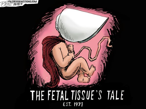 Fetal_Tissue20190122121702.jpg