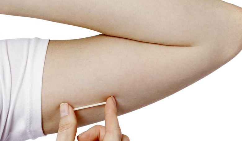 Supply Side Contraceptives