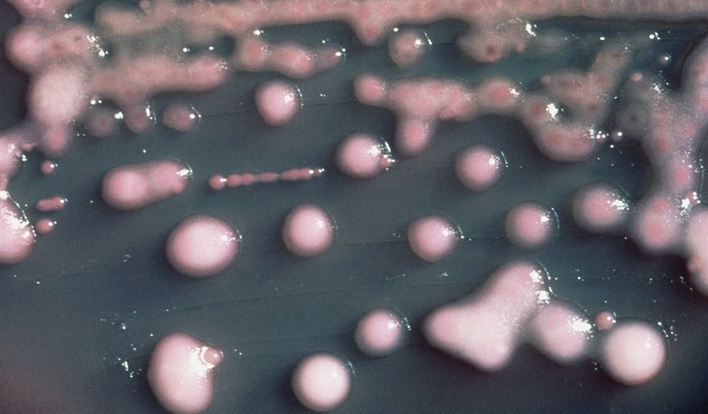 Feds Cover up Hospital Infections 