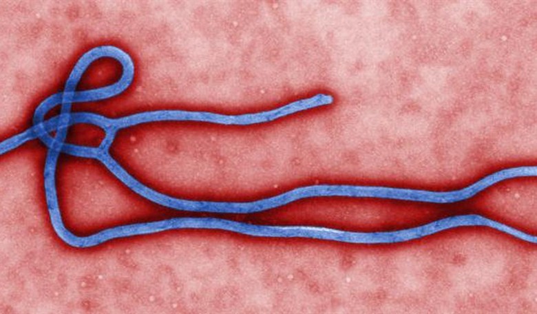 Ebola Doc's Condition Downgraded to 'Idiotic'