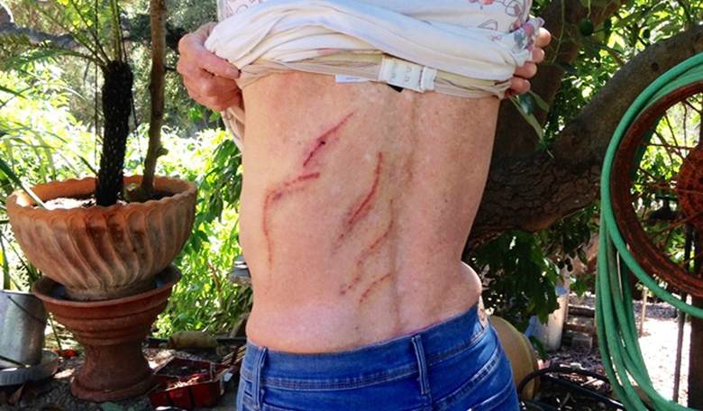 Predator Watch: A Roundup of Dangerous and Deadly Animal Encounters