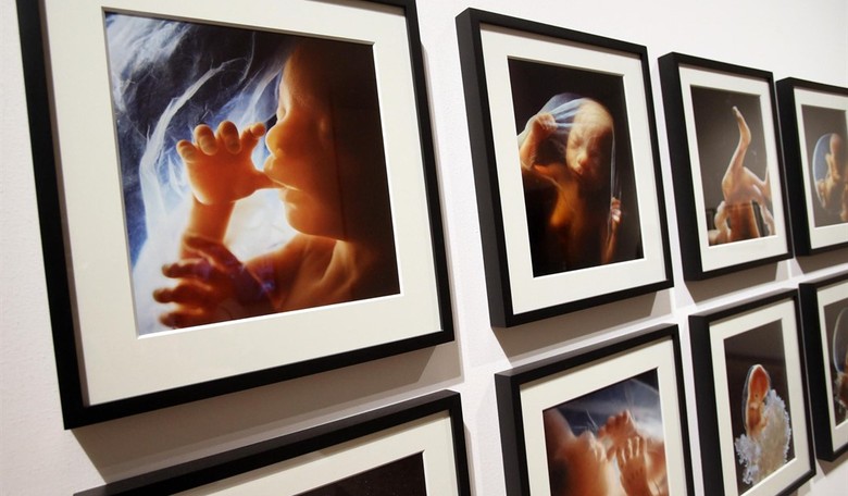 Breaking: South Carolina Supreme Court Backs Six-Week Abortion Ban