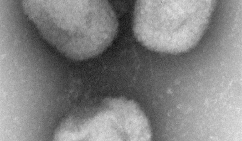 Monkeypox Has a New Name...and It Doesn't Sound Any Better
