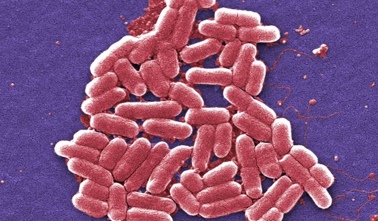 Dirty Hospitals Are to Blame for Superbug Deaths