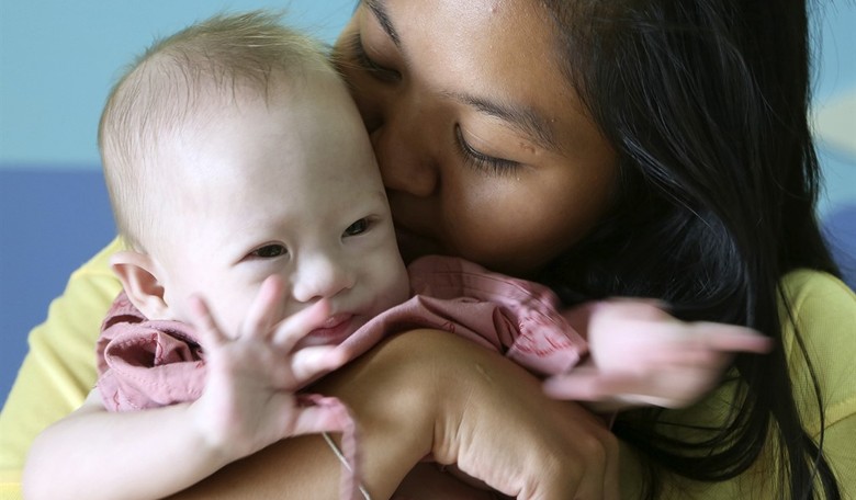 Appeals Court Deems Indiana Ban on Abortions Due to Down Syndrome Diagnosis 'Unconstitutional' 