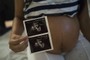 The Owner of a Milwaukee Prenatal Company Latest to Plead Guilty in $5.4M Medicaid Fraud Scheme