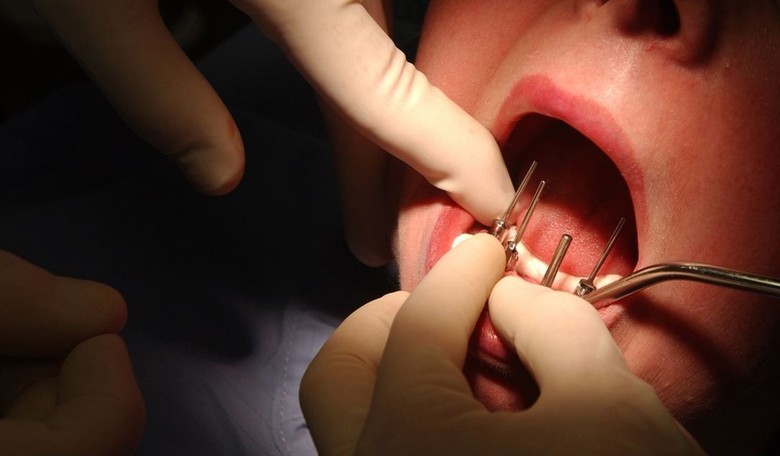 D.C. Dentist, Hygienist Convicted in $4M Medicaid Fraud Scheme