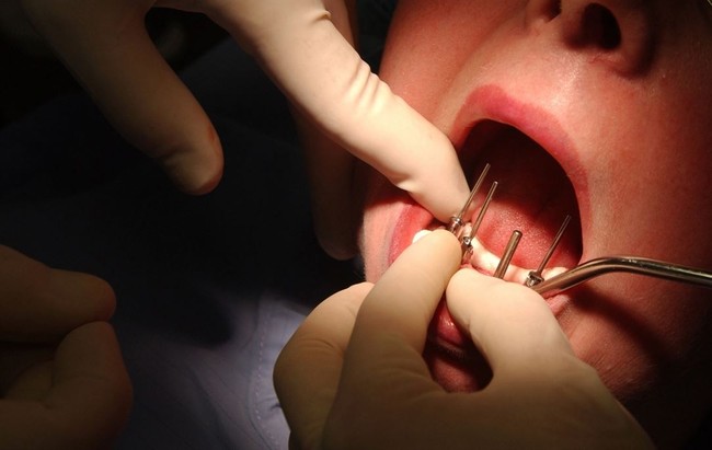 D.C. Dentist, Hygienist Convicted in $4M Medicaid Fraud Scheme