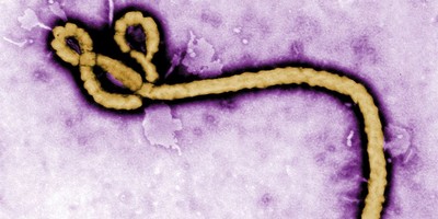 Fauci Diary: Bury NIAID-Funded Army Ebola Aerosol Results