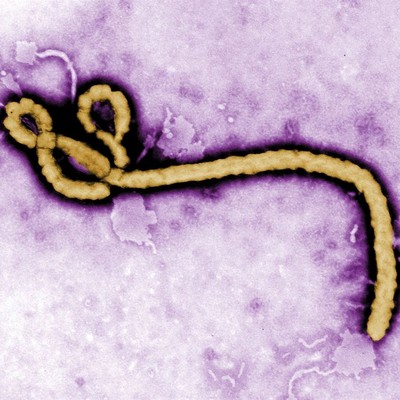 Fauci Diary: Bury NIAID-Funded Army Ebola Aerosol Results