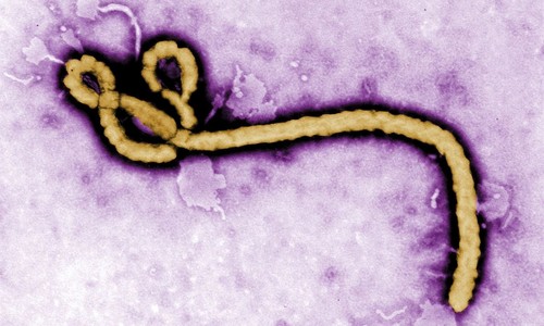 Fauci Diary: Bury NIAID-Funded Army Ebola Aerosol Results