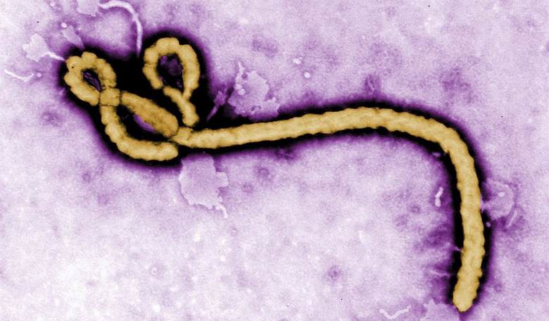 Fauci Diary: Bury NIAID-Funded Army Ebola Aerosol Results