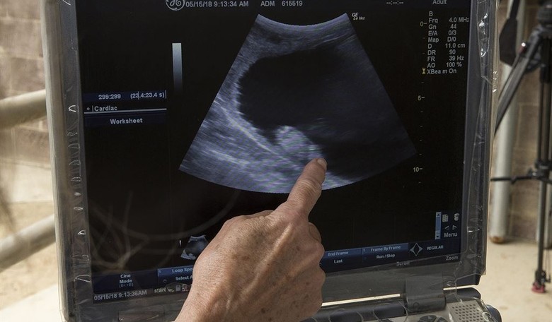 Shocking Allegations of Live Baby Organ Harvesting Deserve Explanation