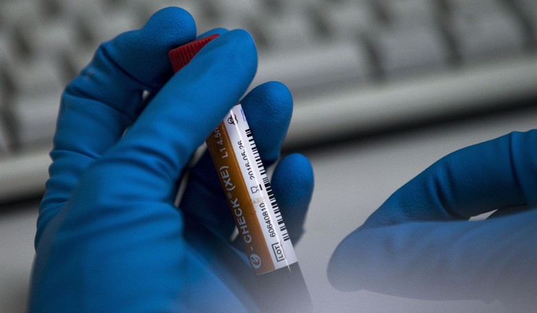 Report: Embalmers Notice Something Very Unusual Happening to Human Blood