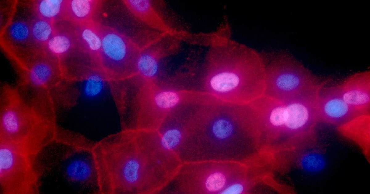 townhall.com - Dmitri Bolt - AI Just Helped Create a Personalized Cancer Vaccine. Welcome to the Future of Medicine.