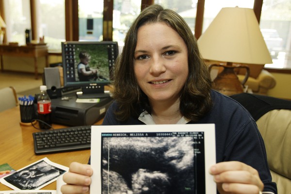 Science Is Making the Humanity of Unborn Babies Harder to Ignore