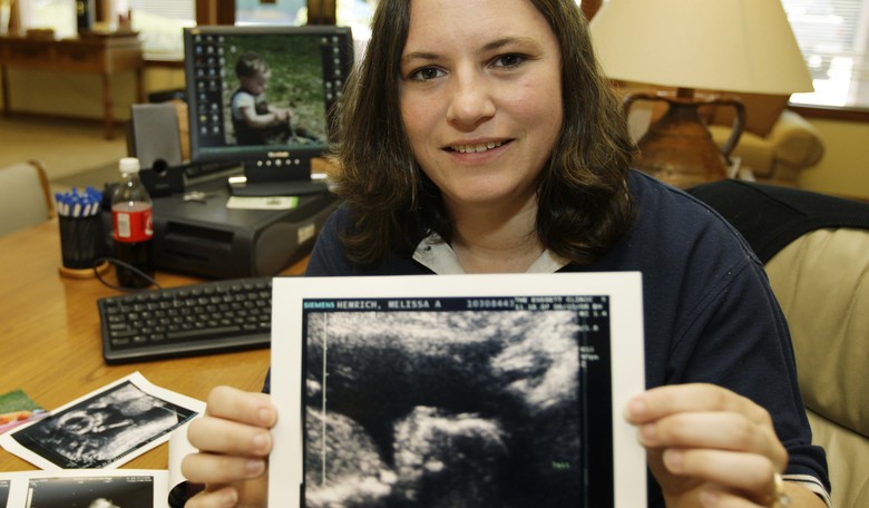Science Is Making the Humanity of Unborn Babies Harder to Ignore