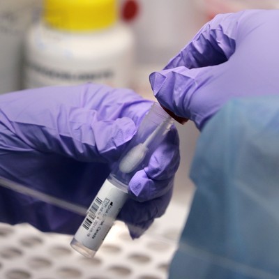 Lab Worker Reportedly Dies of Plague in Siberia; Nearly 200 Placed Under Observation