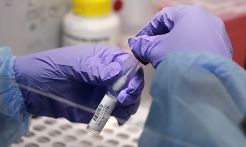 Lab Worker Reportedly Dies of Plague in Siberia; Nearly 200 Placed Under Observation