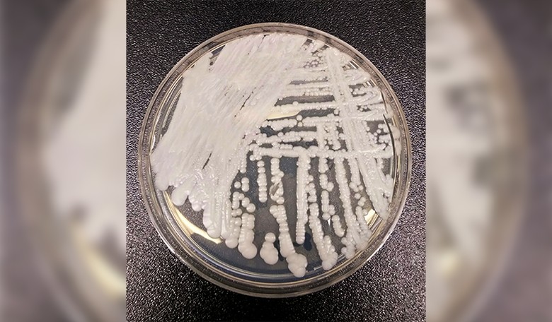 The Deadly Fungal Infection That's Tearing Through Health Care Facilities Like a Brushfire