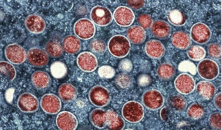 WHO renames Monkeypox because the WHO is filled with racists