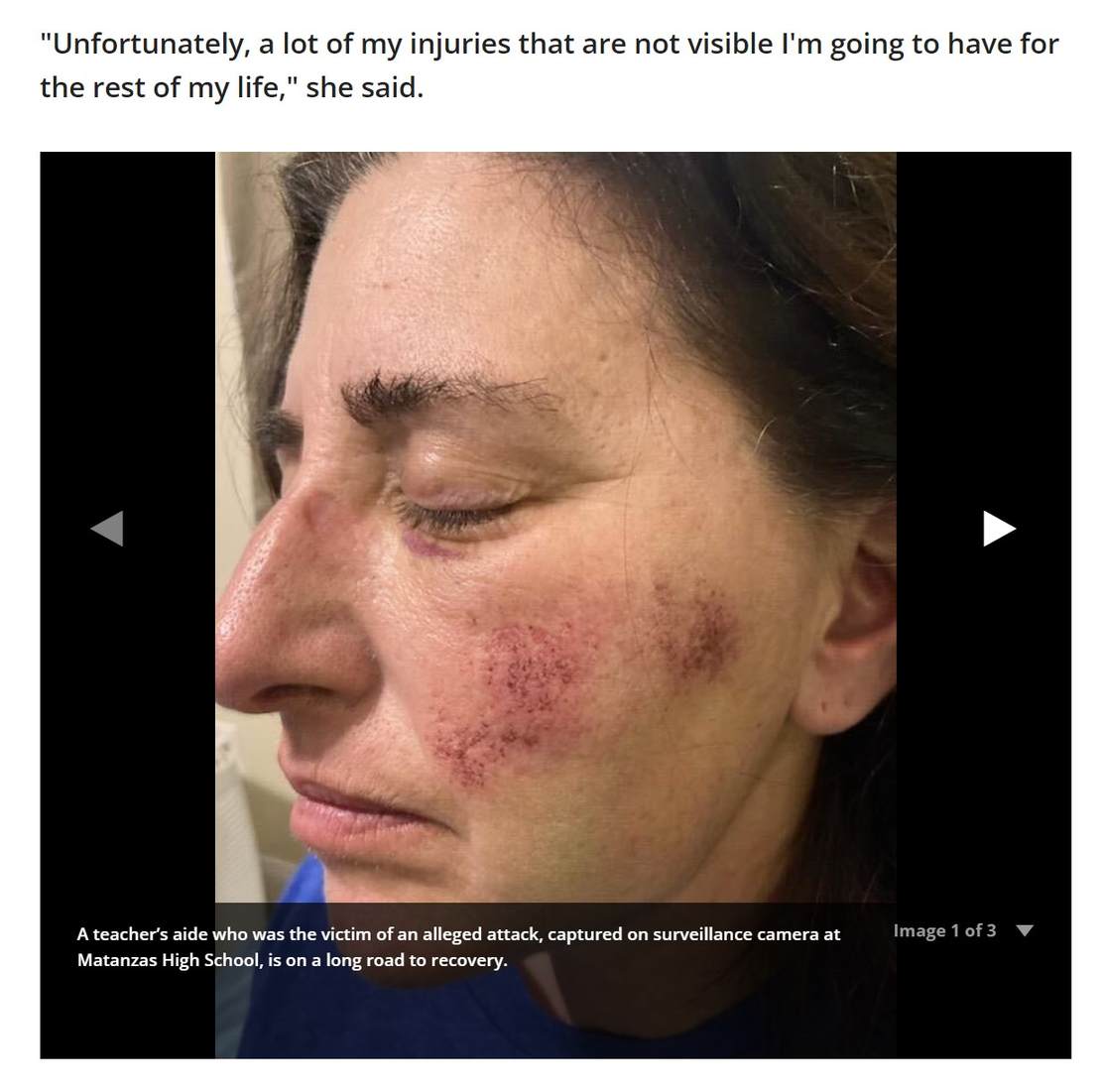 FL Teacher's Aide Beaten by Student Has to Fight Worker's Comp, Flagler School System and Live