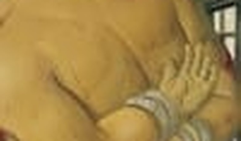 Physicians Report on Torture: A Questionable Case