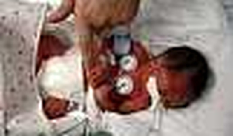 The Doctor Is In: Infant Mortality Comparisons a Statistical Miscarriage