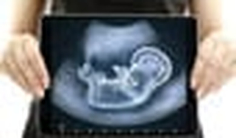 The Ultrasound Mandate and Personal Responsibility
