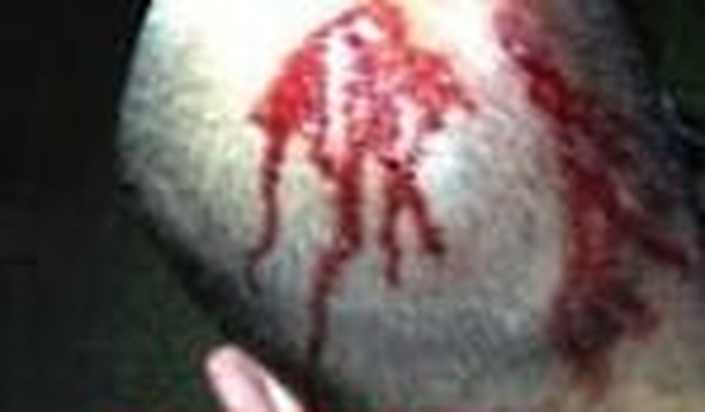 The Backwards Trial: A George Zimmerman Prosecution Primer