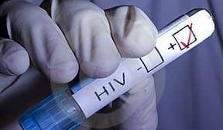 CDC: Minority of HIV-Positive Young Adults Know They're Infected, Few Keep Up Treatment