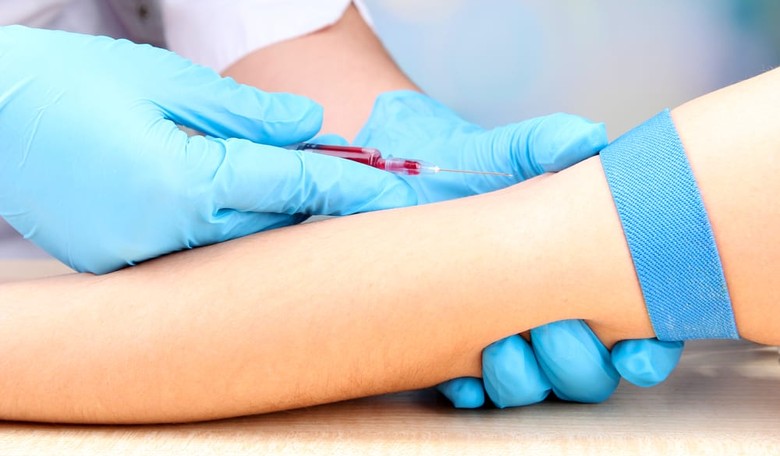 Study Seeks to Determine Whether Ovarian Cancer Screenings Are Worth It