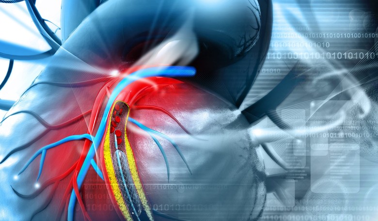 Could a Genetic Mutation Lower Your Risk of Coronary Artery Disease?