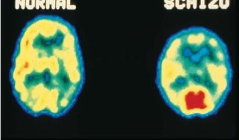 Is There a Cure for Trumpophrenia?
