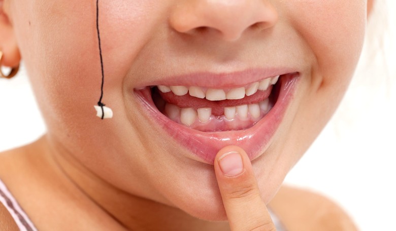 Stem Cells in Baby Teeth Can Now Be Banked, Just Like Cord Blood!