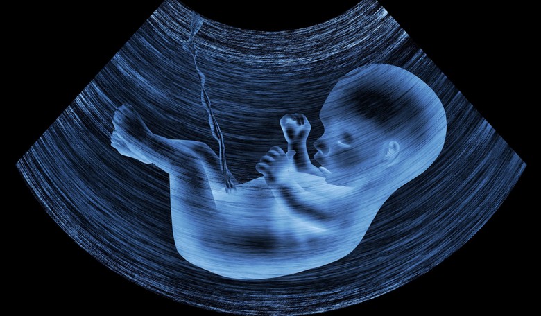 Warning: Antidepressant Use in Pregnancy May Result in Abnormally Long Umbilical Cords