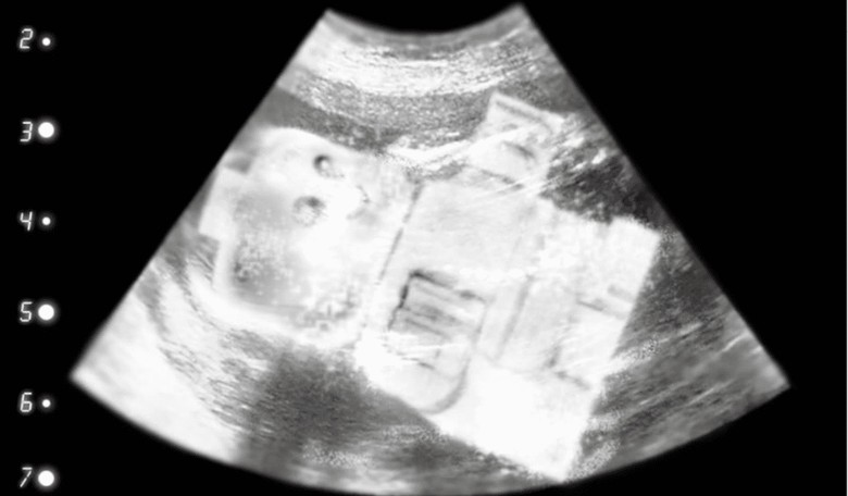 Feminist Outrage Alert! LEGO Announces Baby Minifigure in Ultrasound