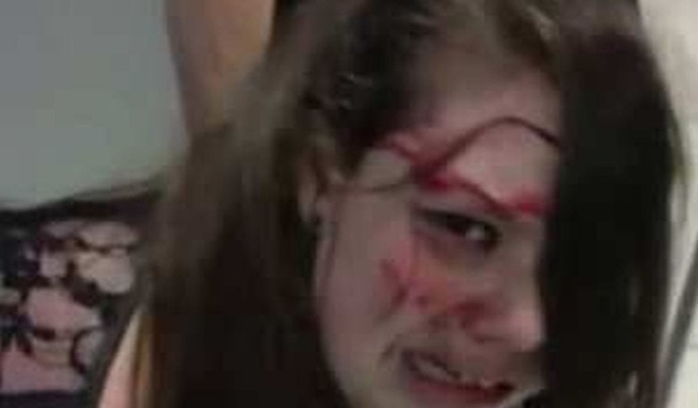 Disabled Teen Beaten Bloody by TSA Agents