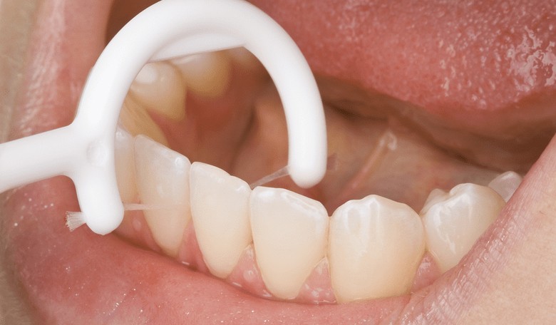 Even the Government-Approved Science Behind FLOSSING Is Not Settled