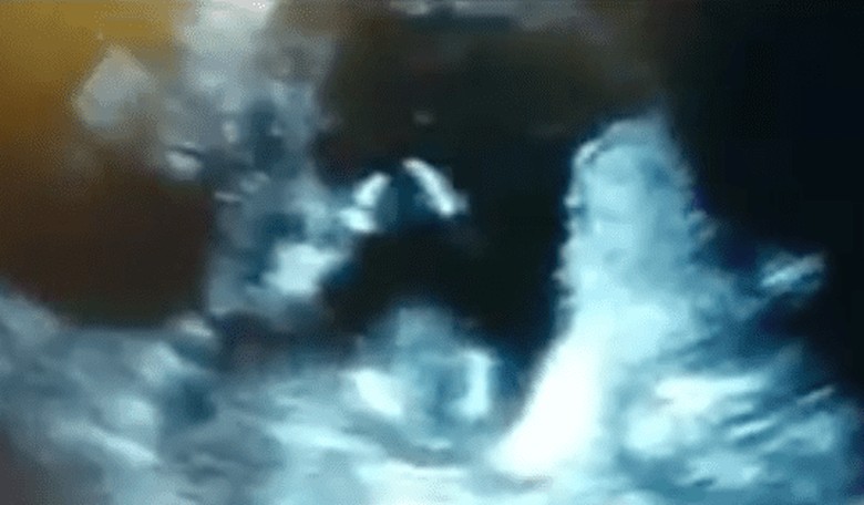 14-Week-Old Fetus Dances to Its Parents Singing