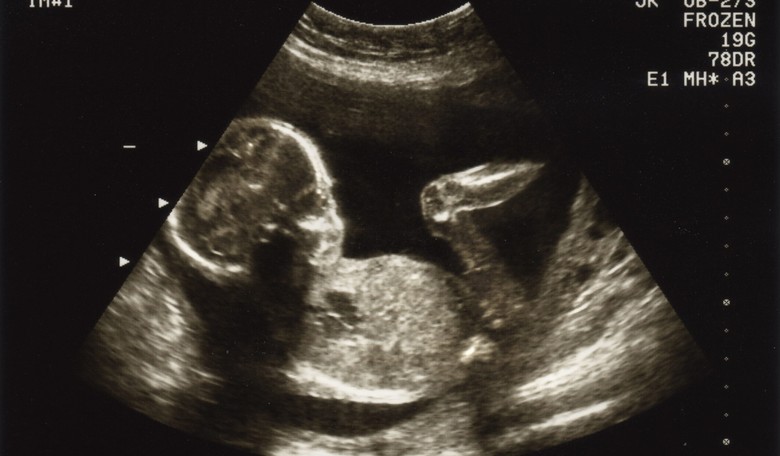 Ohio's Legislature Just Sent Kasich a 'Heartbeat' Abortion Bill That Could Change Everything