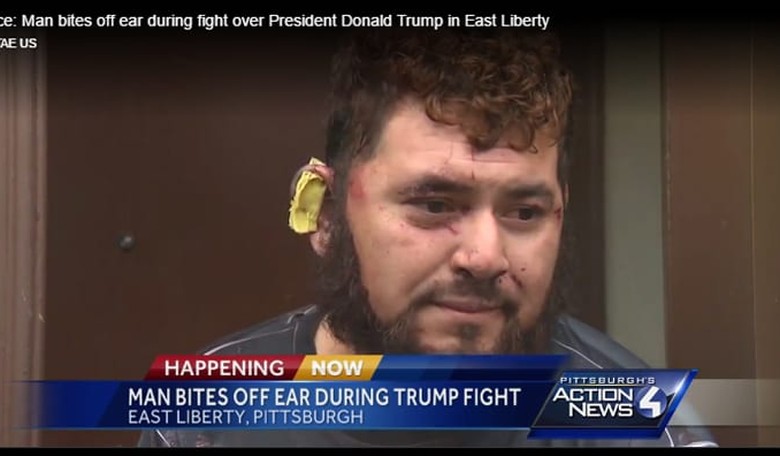 Illegal Immigrant Bites Ear Off of Roommate in Drunken Anti-Trump Rage Attack