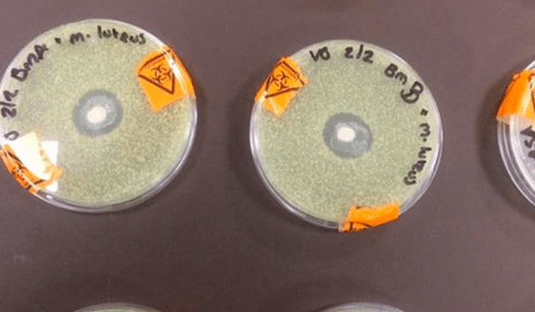 The Internet Is Going Wild Over This Picture of Breast Milk in Petri Dishes