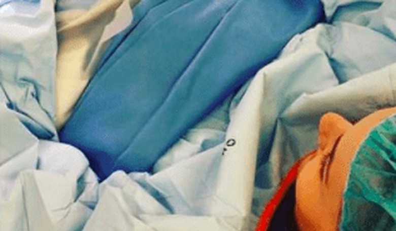 Mother Delivers Her Own Baby via C-Section, Shares Graphic Images