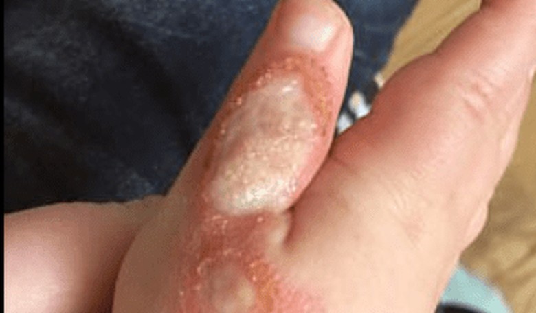 Mother Warns Parents of the Dangers of Vacuum Cleaners