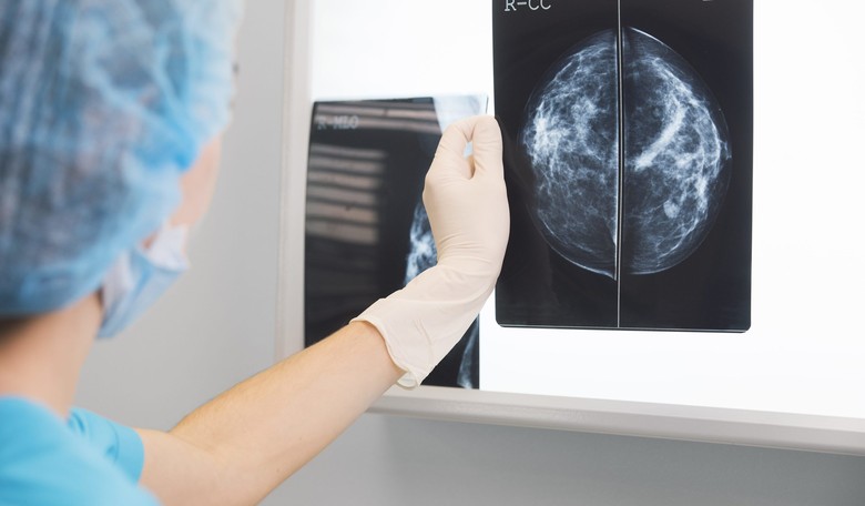 Women with Aggressive Breast Cancer Are Living Longer