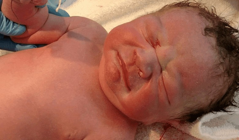 Woman's Failed IUD Found Behind the Placenta of Her Newborn