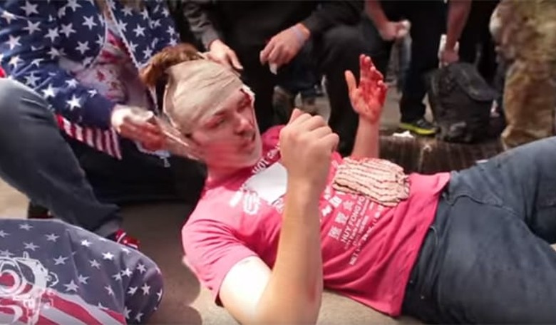 College Professor Arrested as Suspect in Berkeley Assault